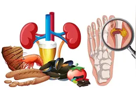 反复痛风引起肾脏疾病，别再让痛风悄悄伤害肾脏图片