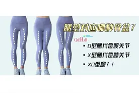 最全腿型解析都在这，腿不直的人对号入座图片