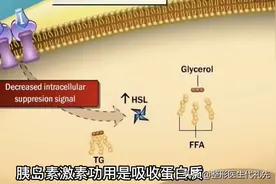 从整形医生的角度谈一谈皮肤松弛下垂的改善方法图片