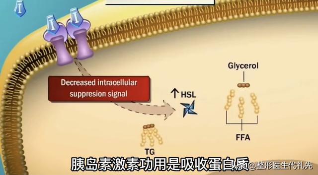 从整形医生的角度谈一谈皮肤松弛下垂的改善方法