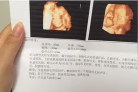 四维彩超除了留念，还藏着胎儿的很多“小秘密”，看懂了吗？图片