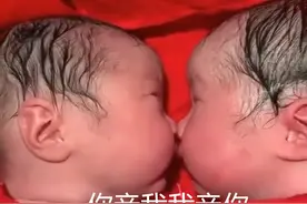 龙凤胎兄妹刚出生就一直亲，护士都分不开，这一幕实在太暖心了图片
