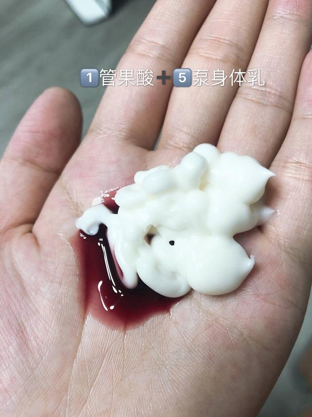 果酸身体乳去闭口