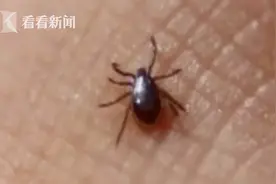 男子钓鱼后发烧咳血进ICU 一查竟感染可怕病毒图片