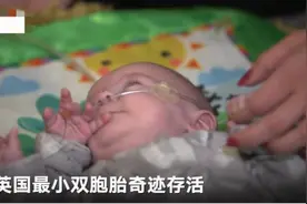 英国最小双胞胎早产儿存活，出生仅400多克，堪称奇迹图片