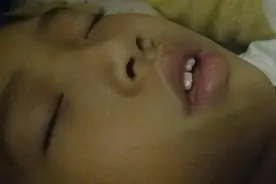 6岁女儿总张嘴睡觉，妈妈用胶带粘上孩子嘴，医生夸她真优秀图片