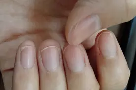 身体好坏，瞧瞧手指甲？竖纹、黑点、月牙代表了什么？图片