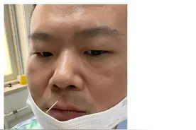岳云鹏身体不适暂停营业，特地发文和粉丝报平安，刚刚针灸治腰疼图片