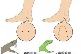 父亲被毒蛇咬伤后，我想给所有人提个醒图片
