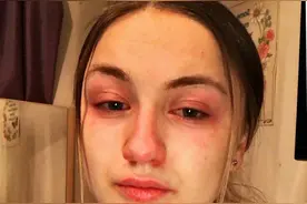 怕传染家人，英国小护士下班后回到家，洗完澡就把自己锁在房间里图片