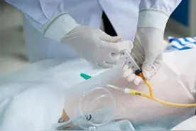 所有手术都要插尿管吗？会多难受？这种“酷刑”般的酸爽，了解下图片