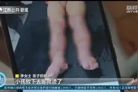 扬州2岁男童洗澡被烫 夏季幼儿烧烫伤频发，家长不得大意图片