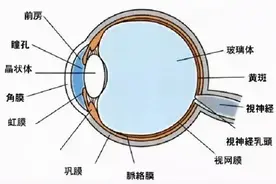 ​谢立科教授：眼前有黑影，不要忽视视网膜脱离图片