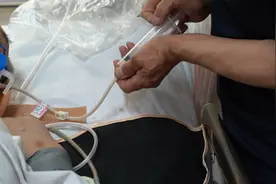 野猪进村袭击石家庄3名村民，一人重伤昏迷10天；村支书：村四周已形成野猪群图片