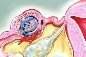 女人怀上“宫外孕”，为何是男人的锅，妇产科医生3句话挑出病因图片