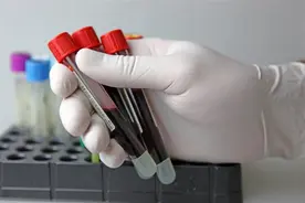 上海交大研究：胆固醇越低，癌症风险越高？4个方法稳控血脂图片