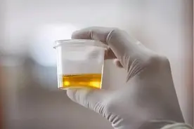 怀疑家人吸毒？哪些检测方法可以确定他是否染上毒品？图片