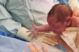 “黏人宝宝”一出生，就伸手向妈妈要“抱抱”，医生都拦不住图片