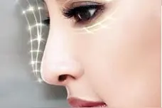 常见的鼻尖整形方法，使用哪种材料效果好呢？图片