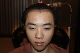 华晨宇粉丝脱粉回踩放猛料！曝其整容植发照片，还称张碧晨是小三图片