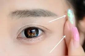 如何去除脂肪粒，为什么会起脂肪粒图片