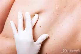 皮肤突然冒出一个个红痣，是肝病的标志吗？中医：还有3点原因图片
