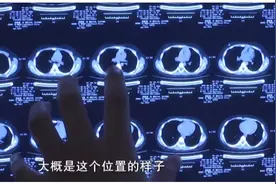 6岁女童突然剧烈呛咳无法说话，医生查明原因让人哭笑不得视频封面