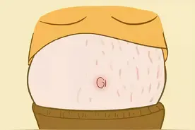 长高、长胖留下的膨胀纹，要如何才能去掉？图片