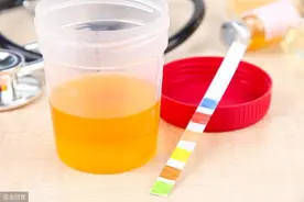 尿里有泡泡！肾脏出问题了吗？一篇文章解决你所有疑问图片