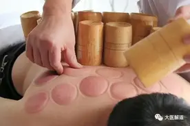 拔火罐，小技巧，大智慧，火罐的秘密，你了解多少呢？图片