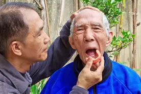 镶了假牙后，要注意什么？牙科医生：这几件事要清楚图片