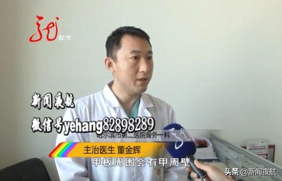 瓶身有花的甲油胶 2026年瓶身有花的甲油胶有毒吗