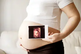 产检里的四维彩超，孕妈妈们最想知道什么？图片