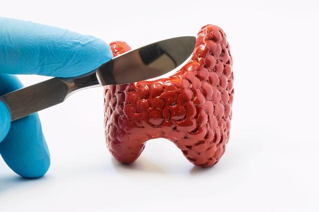 甲状腺最怕2个水果 2026年甲状腺最怕2个水果甲减