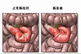 夏天，肚疼腹泻高发期来袭！但这个肚痛可不是简单腹泻......图片