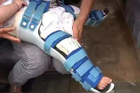 熊孩子因偷摘隔壁桃子，双腿摔成骨折，家长却反要邻居赔偿图片