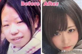 整容的真正意义所在！看看这位25岁日本女孩的华丽转变之路图片