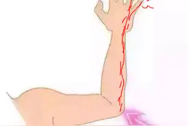 手麻，都是颈椎病？不一定！也可能是患上了这种病图片