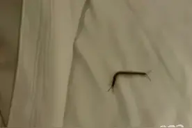 小伙入住襄阳一酒店被蜈蚣咬伤.....图片