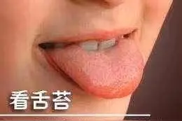 身体好不好，伸出舌头就知道！这几种舌苔的人注意了图片