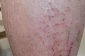 秋冬护肤之保湿有方法图片