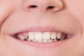 体内有疾，嘴唇先知？嘴唇发出的5种疾病信号，你都读懂了吗？图片