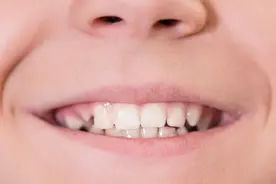 体内有疾，嘴唇先知？嘴唇发出的5种疾病信号，你都读懂了吗？图片