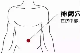 婴儿肠绞痛艾灸可以治愈吗？艾灸肚脐这个穴位有用吗？图片
