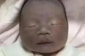“黑宝宝”遭亲妈嫌弃，护士却直夸好看，数月后高颜值征服一家人图片