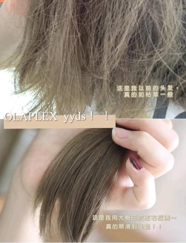 杩囨浮鏈熸€庝箞鍔烇紵鎯崇暀闀垮彂鐨勫濡癸紝杩欏嚑鎷涘府浣犳拺鍒伴閫搁暱鍙? onerror=