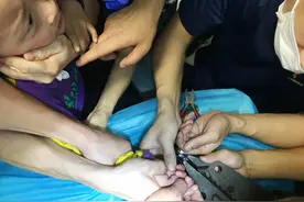 湖北鄂州：男童手指卡钢圈两小时肿胀发紫  家长凌晨驱车救助消防成功救援图片