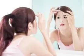 「护肤」脸上长痘痘真的是内脏不好吗？别再耸人听闻了图片