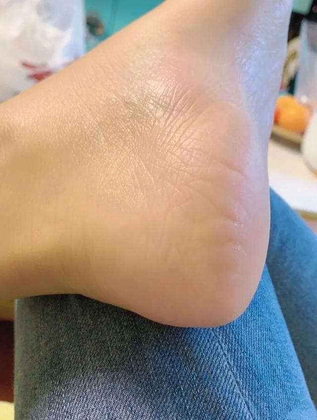 泡完脚能涂身体乳吗