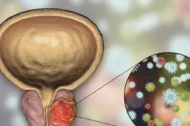男人前列腺不好，3个部位会很疼，若你没有，说明前列腺还算强壮图片